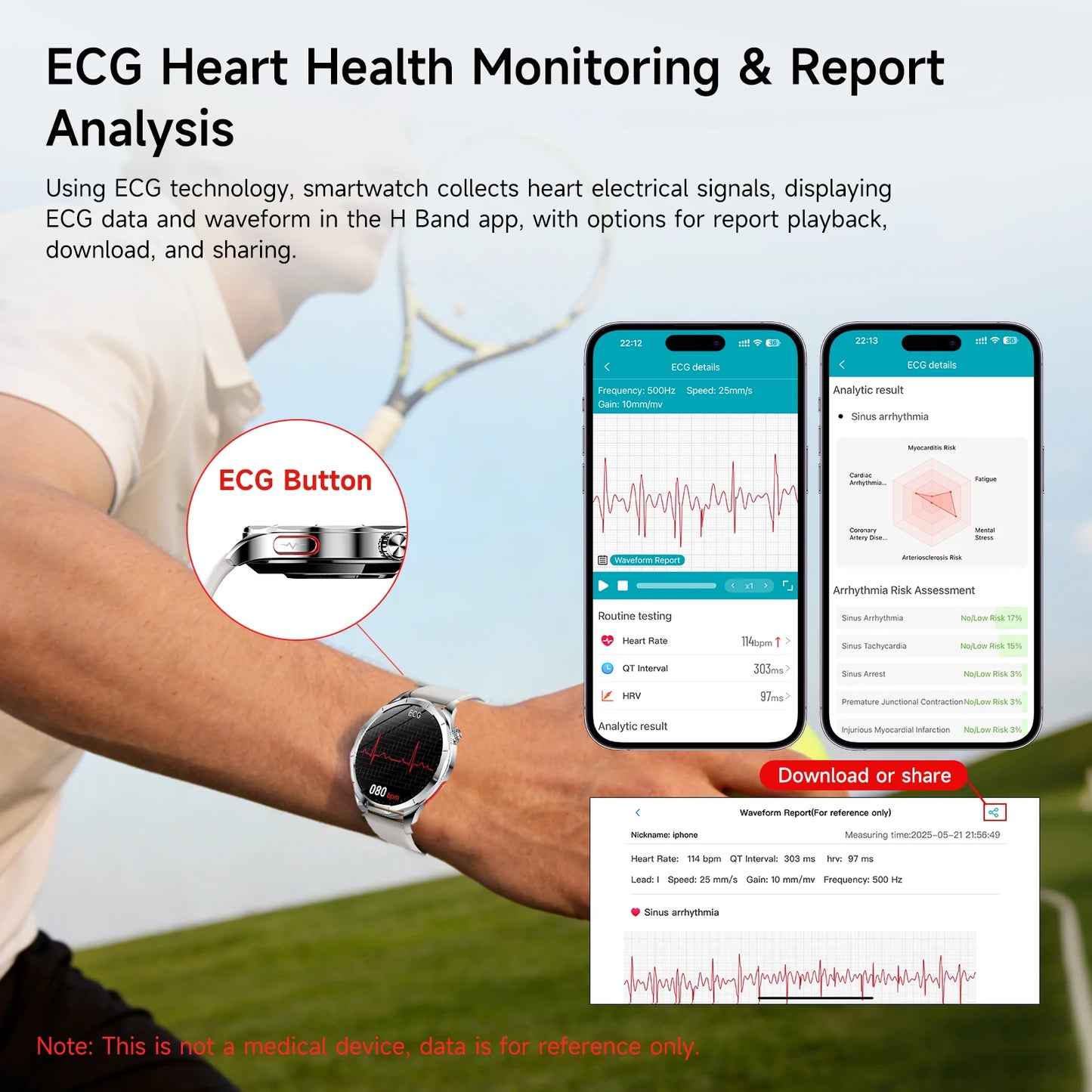 Marsyu AI-GPT Health Smart Watch ECG PPG Body Fat BP